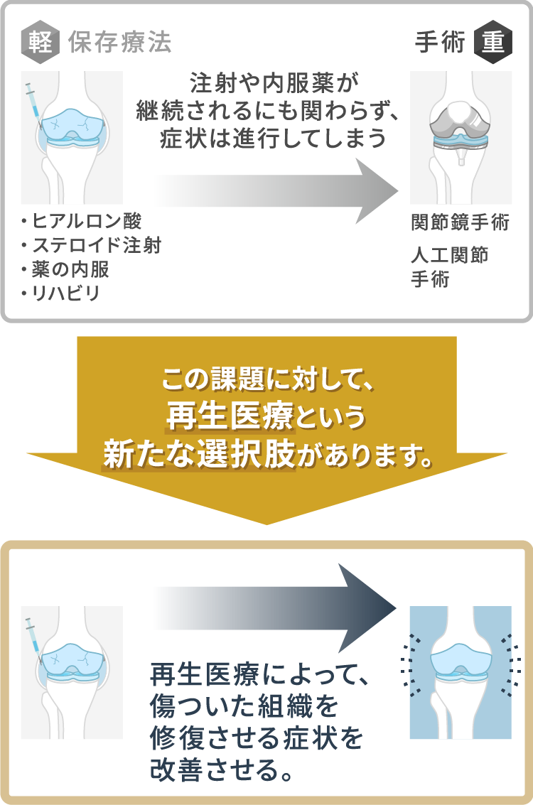 ひざの再生医療